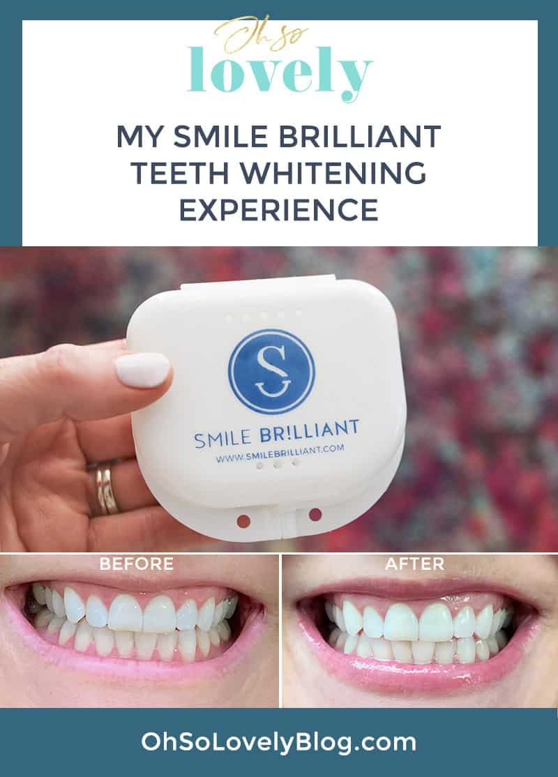 Smile Brilliant teeth whitening review — the results are amazing!